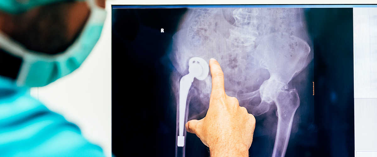 Použití titanu v medicíně