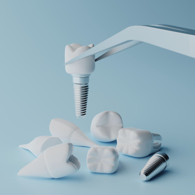 Titanium alloys in medical sector are used to mainly produce implants Titanium alloys in medical sector are used to mainly produce implants